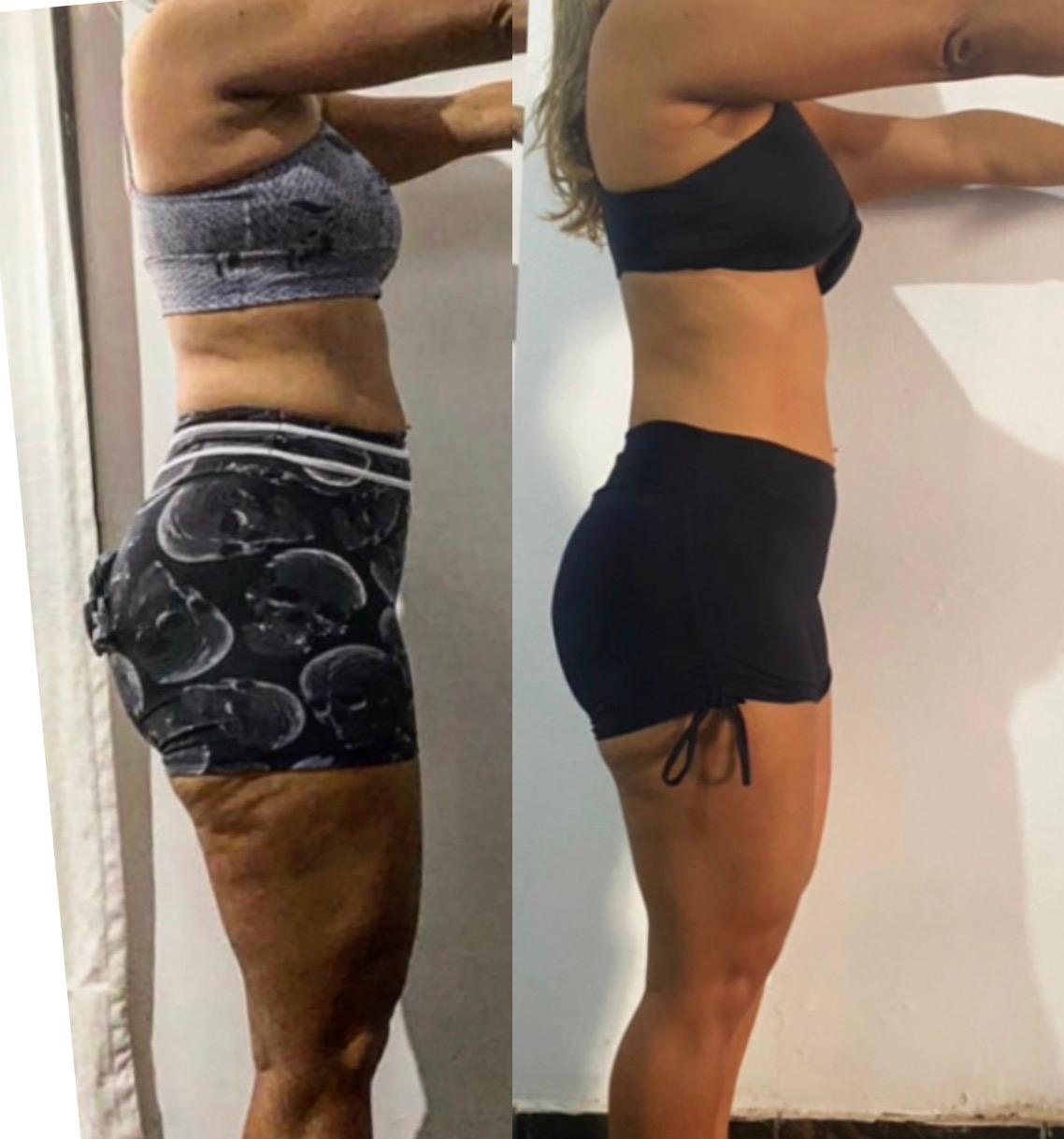 Resultado de aluna do Método Stress Metabólico